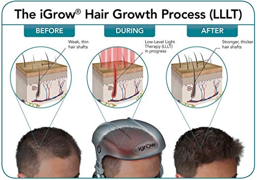 igrow Hair Growth Process